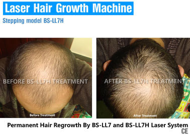 Équipement réglable de traitement de dispositif/perte des cheveux de recroissance de cheveux de laser d'énergie