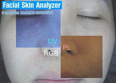 Clinique de beauté/analyseur de portée de peau de machine d'analyse peau de STATION THERMALE 12 mois de garantie