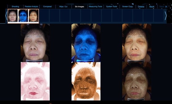 Le spectre 6 voient l'équipement facial d'analyse de peau de problème de peau plus clair