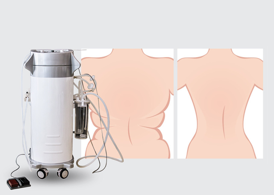 machine chirurgicale de la liposuccion 300W pour la liposuccion arrière supérieure et inférieure