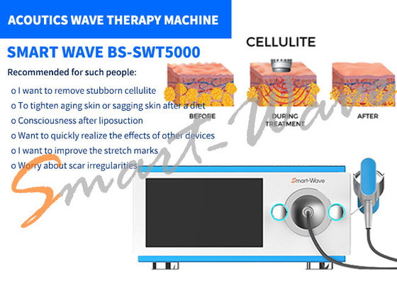 Machine de thérapie d'onde acoustique de 6 émetteurs pour le retrait de vergetures/remodelage de corps