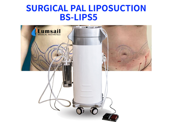 La puissance de BS-LIPS5 300W a aidé l'équipement de liposuccion pour le sein et le Chin de cou