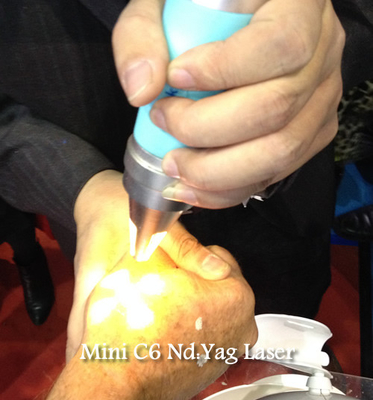 ND 1064 de machine de retrait de tatouage de laser de Yag de haute énergie Yag 532 nanomètre avec du CE approuvé
