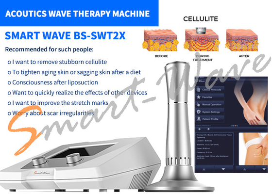Enlèvement de cellulites de machine de thérapie d'onde acoustique du salon de beauté BS-SWT2X garantie de 1 an