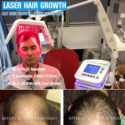 équipement vertical de laser de la diode 650nm pour la recroissance de cheveux