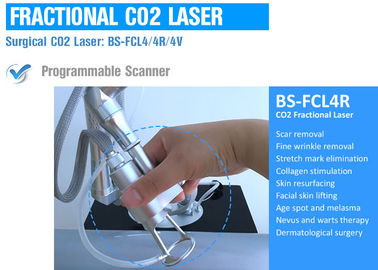 Pelez reblanchir la machine partielle de laser de CO2 pour reblanchir d'épiderme/réduction de ride