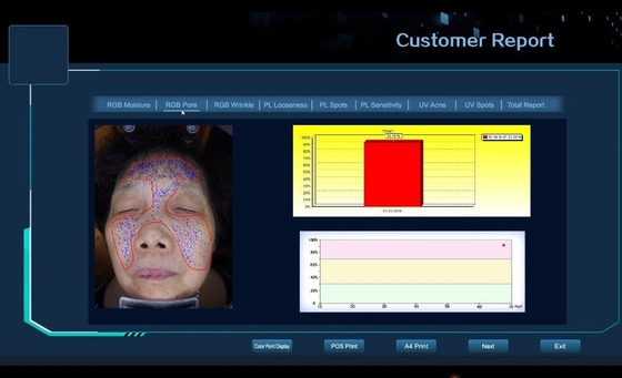 pore facial de peau de machine d'essai de la peau 3D, ride, taches, dispositif d'analyse d'acné