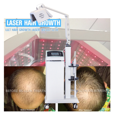 La thérapie de laser de la thérapie LLLT de cheveux élèvent des cheveux avec la vraie machine de recroissance de cheveux de laser de diodes