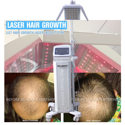 Machine réglable de croissance de laser de cheveux d'énergie avec de vraies diodes lasers de la longueur d'onde 650nm/670nm