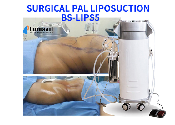 Machine chirurgicale ultrasonique de liposuccion de pal amincissant l'équipement de beauté avec l'ensemble de canule