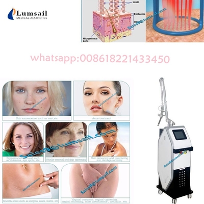 Machine partielle de laser de CO2 de gynécologie pour Vaginal Tightening