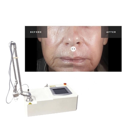 Machine chirurgicale de laser de cicatrice d'acné partielle portative du CO2 15w